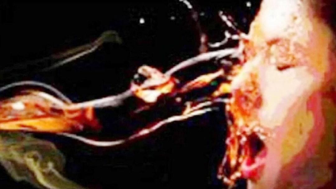 ✍️भाई की सगाई में जाना चाहती थी पत्नी, पति ने नाराज़ होकर डाला तेजाब👉